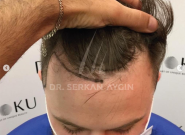 Dr Serkan Aygin Clinic Istanbul
