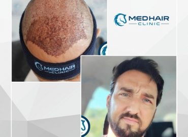 Medhair Clinic Hair Transplant Istanbul
