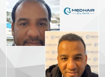 Medhair Clinic Hair Transplant Istanbul